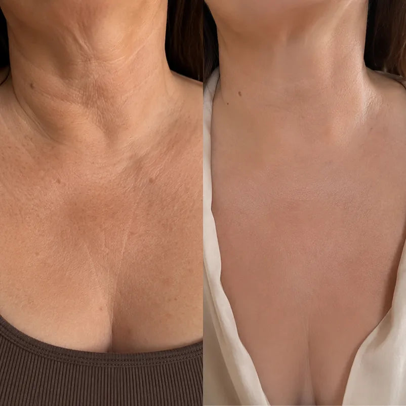 HISKIN®3 Tri-Lift Peptide Complex
