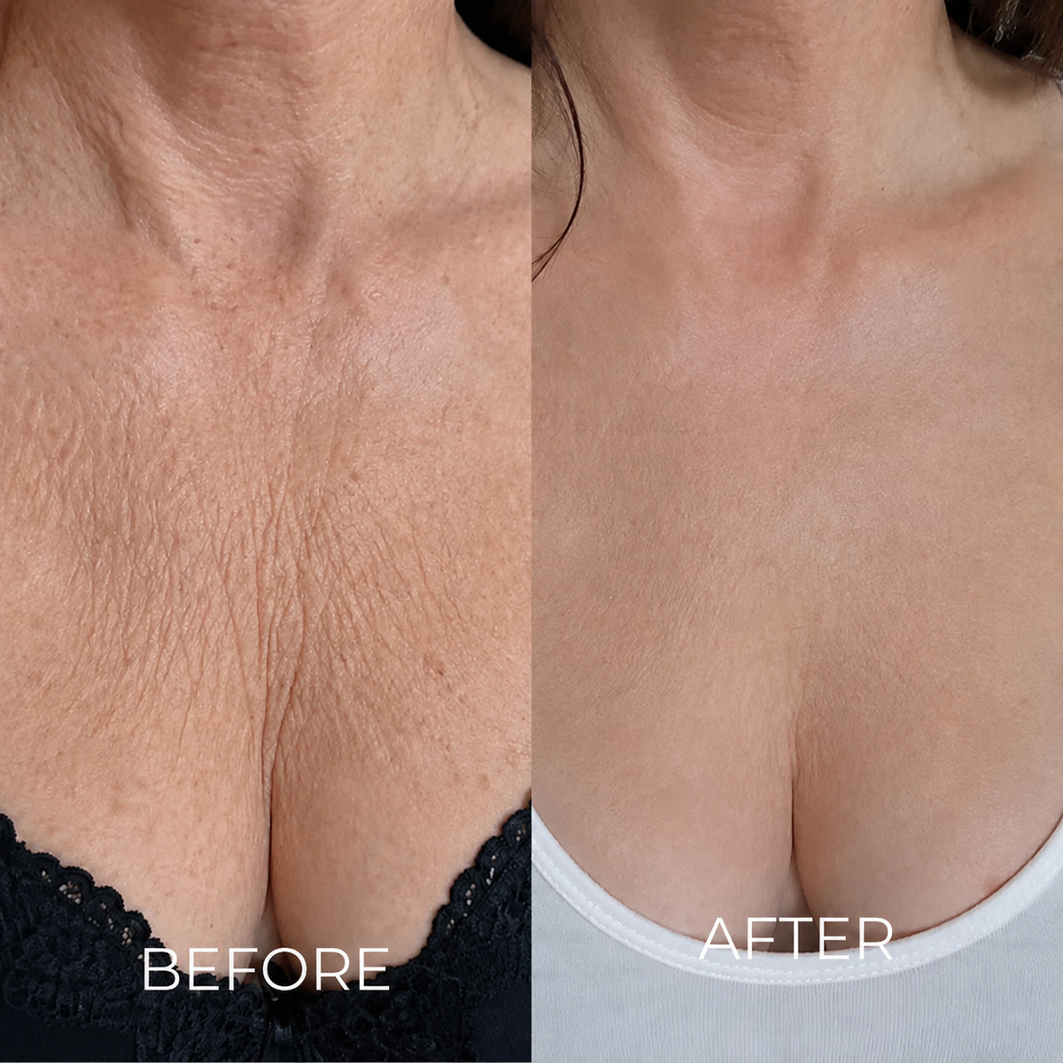 HISKIN®3 Tri-Lift Peptide Complex